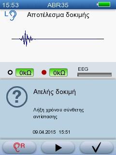5 Δοκιμή με το AccuScreen διαφορές σύνθετης αντίστασης. Ο θόρυβος στο καλώδιο του ηλεκτροδίου εξαρτάται σε μεγάλο βαθμό από τις τιμές σύνθετης αντίστασης.