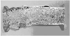STOMATOLOGIJA Proteza umjetnog kuka Stent