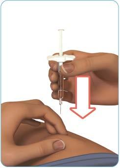 ) Figura H Pasul 6: Injectați medicamentul Țineți seringa preumplută de Zinbryta la un unghi de 45-90 față de locul de