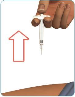 Pasul 7: Scoateți seringa preumplută de Zinbryta din locul de injecție Trageți acul drept în afară. (Vezi Figura K.) Atenţie - nu puneți capacul la loc pe seringa preumplută de Zinbryta.