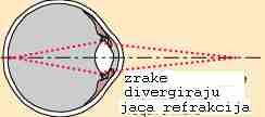 , b) predet u bliskoj točki x= 0.5 x = 0.0 + = 0.5 0.0 f pa slijedi da se f sanjio na 0.08,a jakost povečala na 54 Dpt. 5.3.