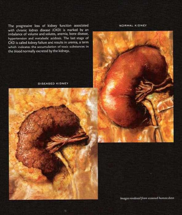Macroscopic