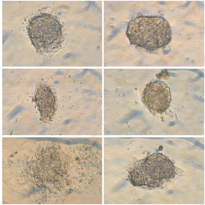 Το GLP-1 διατηρεί τη μορφολογία των ανθρώπινων νησιδίων in vitro Τα παγκρεατικά νησίδια που καλλιεργήθηκαν απουσία του GLP-1 έχασαν την ικανότητα οργάνωσής τους μετά από 5 ημέρες Έως την ημέρα 5, το