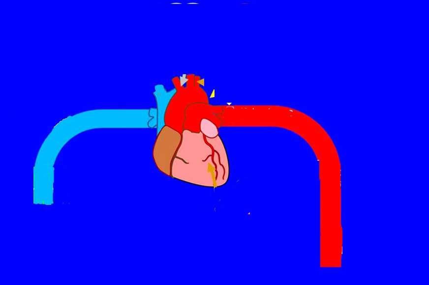 Ghani MA et al, Diabetes Care 2016 May;