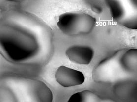 Caracteristici: compoziţii: fosfaţi de calciu pe bază de β-tcp, HAP, β-tcp/hap; metoda folosită: tehnica replicării spumei poliuretanice; produse: structuri 3D
