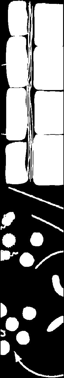 Symbiodinium (κοινώς ονομάζεται