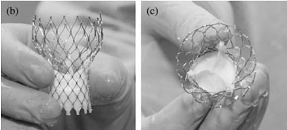 PARTNER US IDE Medtronic CoreValve System, LLC (formerly CoreValve, Inc.