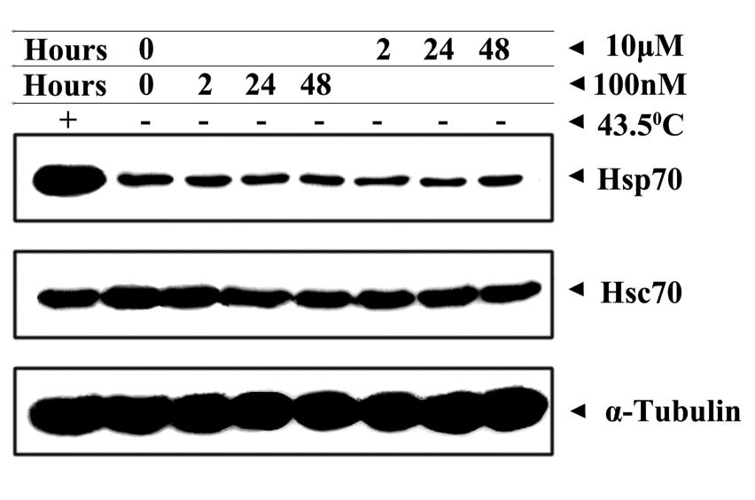 50 ενδοκυτταρικά επίπεδα της ΗSP 70 και δεν ενεργοποιεί περαιτέρω τον αντιαποπτωτικό μηχανισμό που βασίζεται στην hsp70. Εικόνα 4. Ανάλυση Western blot.