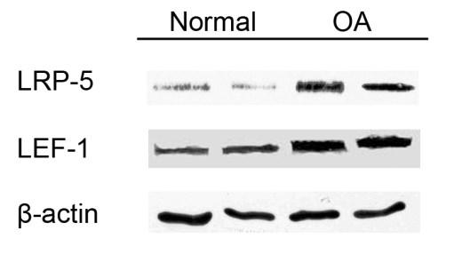 (p<0.05) (Εικόνα 18α). Η αύξηση της έκφρασης των ανωτέρω γονιδίων επιβεβαιώθηκε και σε πρωτεϊνικό επίπεδο με τη χρήση της μεθόδου Western blot (Εικόνα 18β και γ).