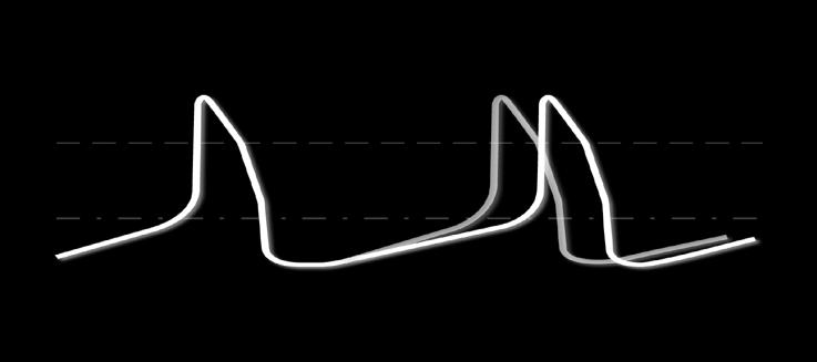 ΜΖΥΑΝΗΜΟ ΓΡΑΖ ΗΒΑΜΠΡΑΓΗΝΖ Sinus node channels Ca channel T- type Η