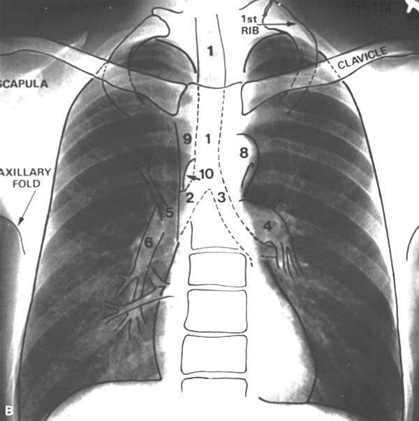 1. Trachea 2. R main bronchus 3. L main bronchus 4. L pulm artery 5. RUL pulm vein 6.