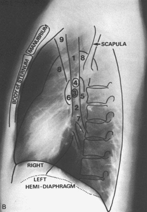 1. Trachea 2. R main bronchus 3. LUL bronchus 4. RUL bronchus 5. L pulmonary artery 6. R pulmonary artery 7.