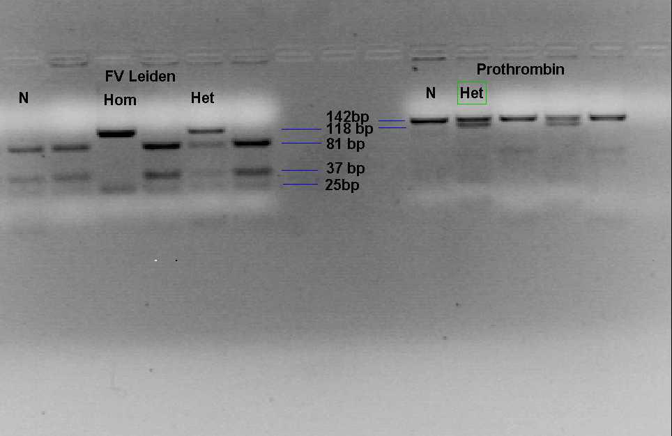 ( +. /0 -. DNA ) 500 bp. 100 ml '2 1x - 3,5, ). &+ 4 + 20 l. -,. +./ -, */ - +)., + - DNA (ladder) (/) 123 bp). + 100 Volts, 2..! : & 20210&:, 142 *). ) 20210&:, 3, 24, 118 142 *).