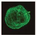 Αλλαγή στη μορφολογία του δικτύου μικροσωληνίσκων κατά την κυτταρική διαίρεση