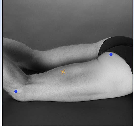 4 Εικόνες 2, 3 και 4: Τοποθέτηση των ηλεκτροδίων στους εξεταζόμενους μυς (ΕσΠλ, ΕξΠλ και ΔικΜ αντίστοιχα) σύμφωνα με τις συστάσεις του SENIAM.
