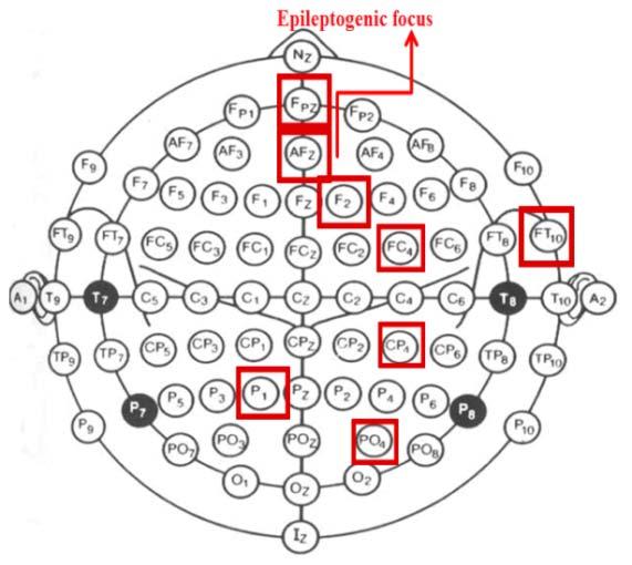 (6)] and scale free distribution [Barabasi et al. (999)], both very important for the detection and analysis of synchronization phenomena [Stam et al. (7)].