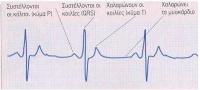 ΔΙΑΓΝΩΣΗ ΚΑΙ ΘΕΡΑΠΕΙΑ ΡΥΘΜΙΣΤΙΚΩΝ ΔΥΣΛΕΙΤΟΥΡΓΙΩΝ Καρδιογράφημα Σε γενικές γραμμές, δυο είναι οι συνήθεις ηλεκτρονικές συσκευές που χρησιμοποιούν οι καρδιολόγοι για να ελέγξουν αν η καρδιά λειτουργεί