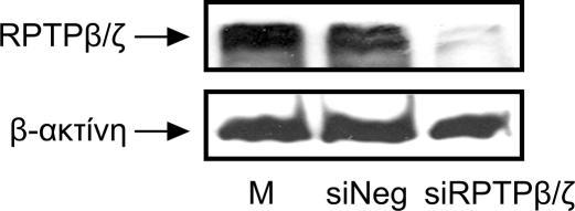 Αποτελέσματα A B P<0.01 100 P<0.01 % Έκφραση RPTPβ/ζ 80 60 40 20 0 M sineg sirptpβ/ζ Εικόνα Α1. Μείωση της έκφρασης του υποδοχέα RPTPβ/ζ με χρήση sirna σε κύτταρα C6.