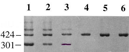 Στην παραπάνω εικόνα παρουσιάζεται το προϊόν ηλεκτροφόρησης RT-PCR του εν λόγω εξονίου σε ένα δείγμα 6 χοίρων (Μarkund et al.,998, Gen. Research,8(8): 86-833).
