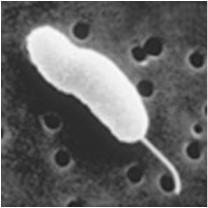 Photobacterium Plesiomonas Vibrio Pasturellaceae Actinobacillus