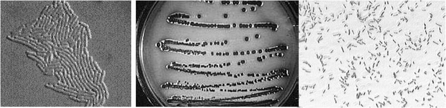 Escherichia είδος Escherichia coli Κύτταρα Escherichia coli Αποικίες σε άγαρ Χρώση Gram Το Escherichia coli είναι κοινό μέλος της μικροχλωρίδας του παχέος εντέρου.