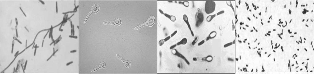 Σποριογόνοι Gram-θετικοί βάκιλλοι Clostridium C. botulinum C. tetani (σπόρια) C. difficile (σπόρια) C.