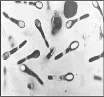 Σποριογόνοι Gram-θετικοί βάκιλοι Clostridium Clostridium difficile (σπόρια) Το C.
