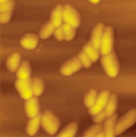 Escherichia coli.