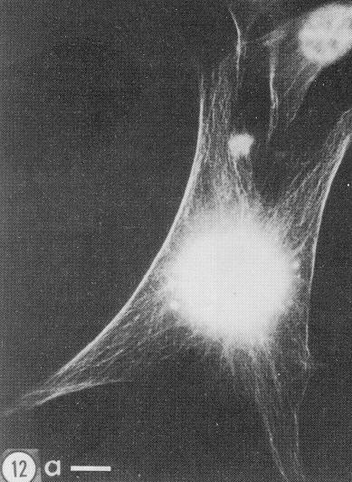 Goldman, R. et al, 1976 Βιολογία Δ.