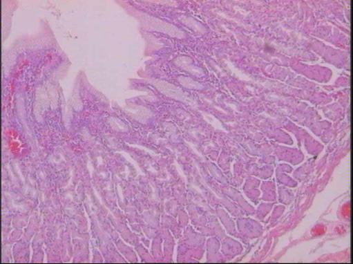 εντεροενδοκρινικά κύτταρα (Εικόνα 1.25). Τα γαστρικά βοθρία εδώ έχουν μεγαλύτερο μήκος. Εικόνα 1.24 Ιστολογική εικόνα βλεννογόνου σώματος του στομάχου (χρώση αιματοξυλίνης-ηωσίνης).