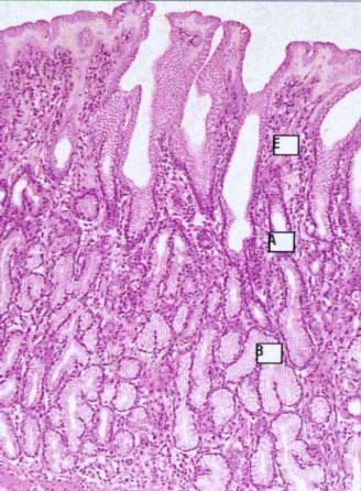 Το πυλωρικό άντρο (Εικόνα 1.29), περιέχει τα κύτταρα G που εκκρίνουν γαστρίνη (Εικόνα 1.30) και βλεννοπαραγωγά κύτταρα.
