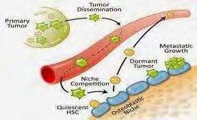 Κεφάλαιο 3ο Μετάσταση Ο μηχανισμός των μεταστάσεων Ο καρκίνος είναι μία ομάδα ασθενειών που προκαλούνται από τον άναρχο πολλαπλασιασμό παθογόνων κυττάρων.