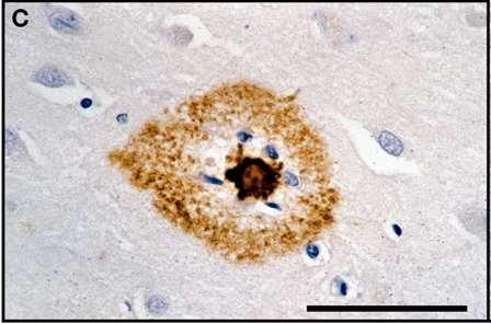 fragmenta amiloidnega prekurzorskega proteina (ponavadi ostanki 1-40 ali 1-42) (receptor na