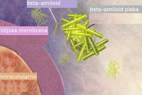 β-amiloid zapravo nastaje od većeg proteina tzv. amiloidnog prekursor proteina (APP). Gen za taj protein smješten je na 21.
