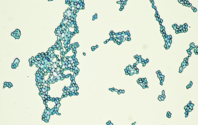 Prokarüootides puuduvad kidlad membraaistruktuurid, kuid edes o mitmed valgud raku vesikeskkoas e. tsütosoolis (igl. cytosol) siiski omavahel orgaiseeritud.