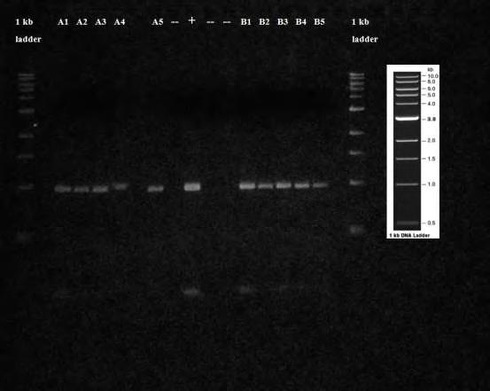 Εικ. 36 Αποτέλεσμα ηλεκτροφόρησης των προϊόντων της PCR με χρήση του ζεύγους εκκινητών COI- SO-FWD / COI-SO-REV σε πηκτή αγαρόζης 1.2%. Ladder: 1kb DNA ladder, Α 1 : 5% S.