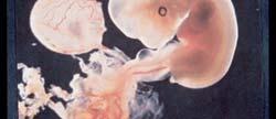 Ο κίνδυνος από την έκθεση του εμβρύου στην ακτινοβολία εξαρτάται από: Το στάδιο της κύησης Ο κίνδυνος είναι μεγαλύτερος στην περίοδο