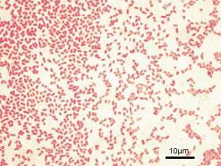 Από τα gram αρνητικά βακτήρια που εμφανίζονται συχνότερα σε ενδονοσοκομειακές λοιμώξεις και ειδικότερα στους ασθενείς στη ΜΕΘ είναι η Pseudomonas aeruginosa, το Acinetobacter baumannii και η