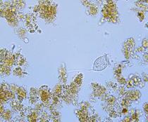 Vorticella canvalaria mg L -1