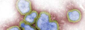 Επιστήμονες ανακαλύπτουν την Αχίλλειο Πτέρνα της γρίπης: : Αντιοξειδωτικά http://www.sciencedaily.com/releases/2009/10/091029125538.