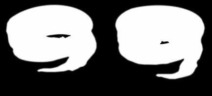 26160023