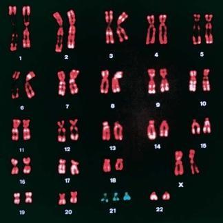 Κάθε ανθρώπινο κύτταρο έχει 46 χρωμοσώματα 2 από κάθε είδος.