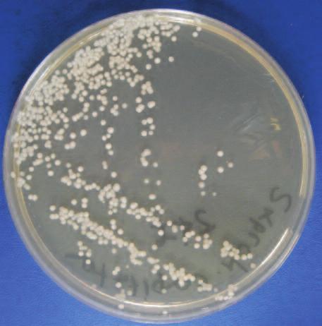 S. CAPITATA FUNGEMIA IN A PATIENT WITH CHRONIC NEUROLOGICAL & HEMATOLOGICAL