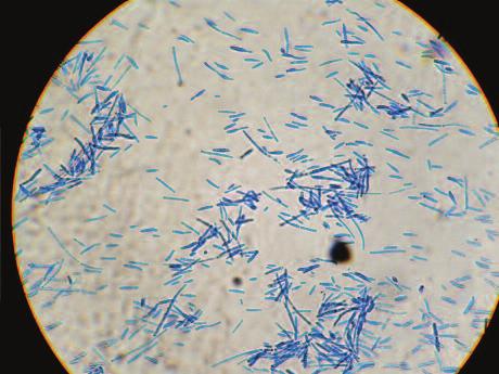 isolated colonies of Saprochaete capitata showed cyclindrical-clavate conidia