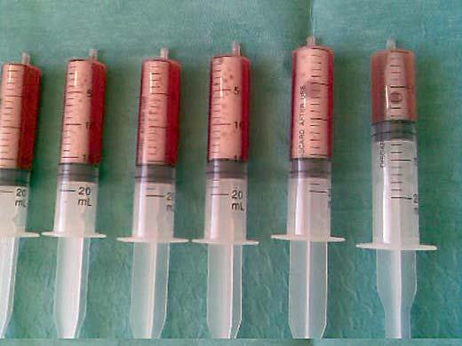 888/μL (76% poly) Hb 10,4 g/dl Creatinine: 1,3 mg/dl