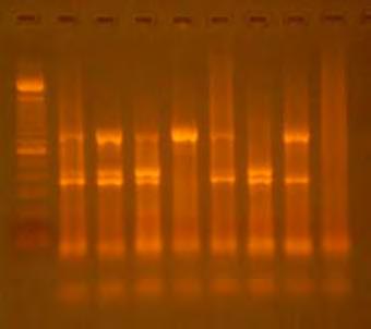4.2.2.Multiplex PCR CAV που εφαρμόστηκε στα κλινικά δείγματα Coxsackie A Στη Multiplex PCR CAV που εφαρμόστηκε στα κλινικά δείγματα Coxsackie A όλα τα δείγματα εκτός από το A9/He1 εμφάνισαν τον