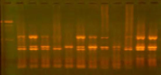 4.2.4.Multiplex PCR CΒV που εφαρμόστηκε στα κλινικά δείγματα Coxsackie Β Στη Multiplex PCR CΒV που εφαρμόστηκε στα κλινικά δείγματα Coxsackie Β όλα τα δείγματα εμφάνισαν το προϊόν του ζεύγους