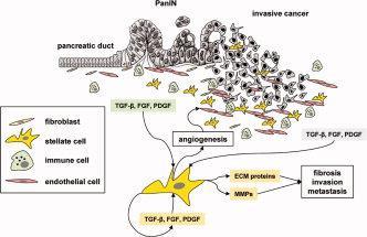 Εικόνα 3: Αλληλεπιδράσεις των παγκρεατικών αστεροειδών κυττάρων (PaSCs) με το μικροπεριβάλλον του όγκου και τα καρκινικά κύτταρα.