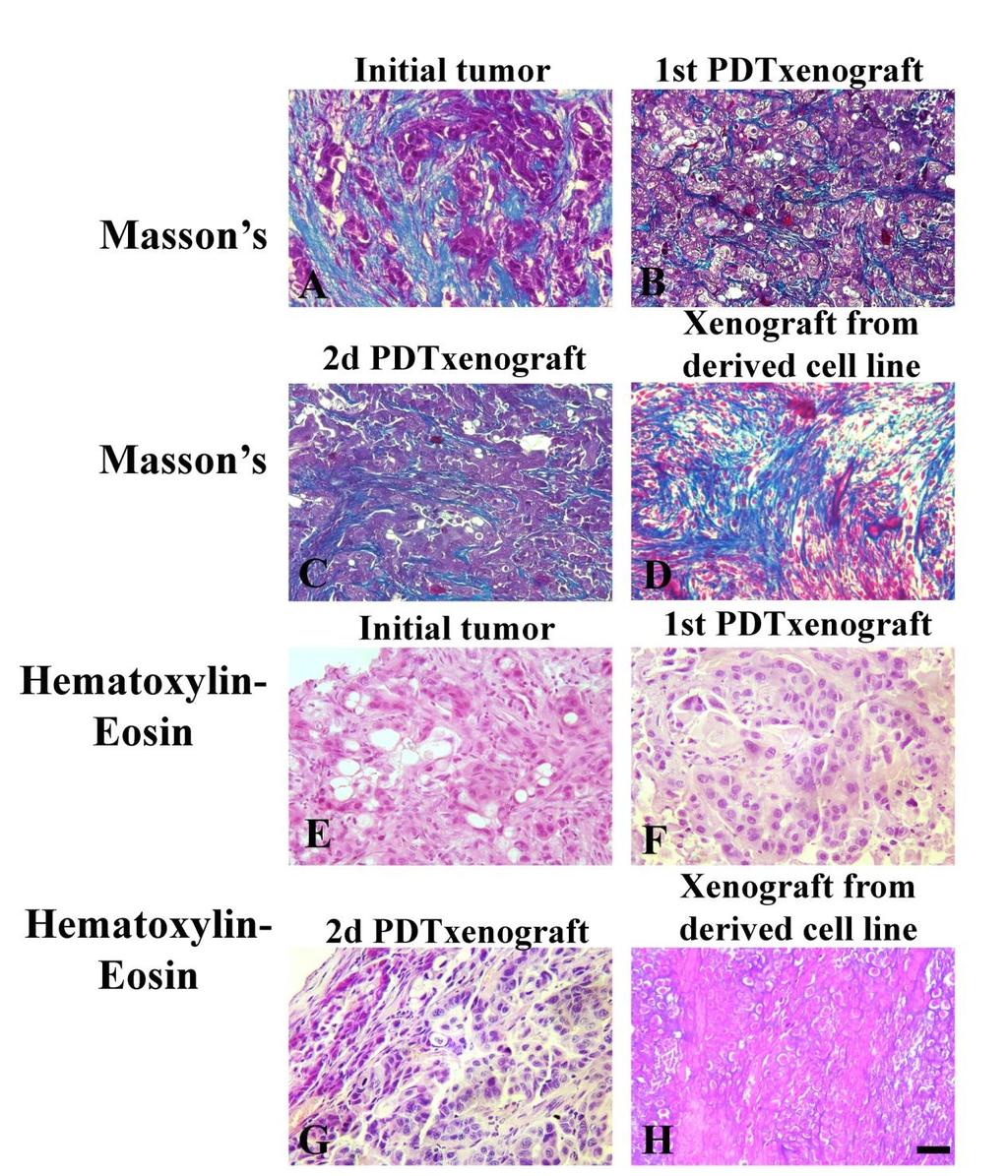 Εικόνα 13: Ίνωση παρατηρείται και σε άλλα μοντέλα παγκρεατικού καρκίνου.