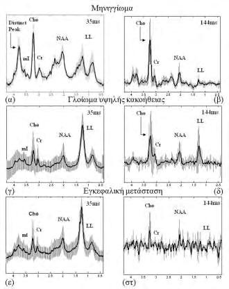 Πίνακας 5.2.1: Μέσες τιμές και οι αντίστοιχες τυπικές αποκλίσεις των κλασμάτων των μεταβολιτών σε χρόνο ηχούς 35msec.